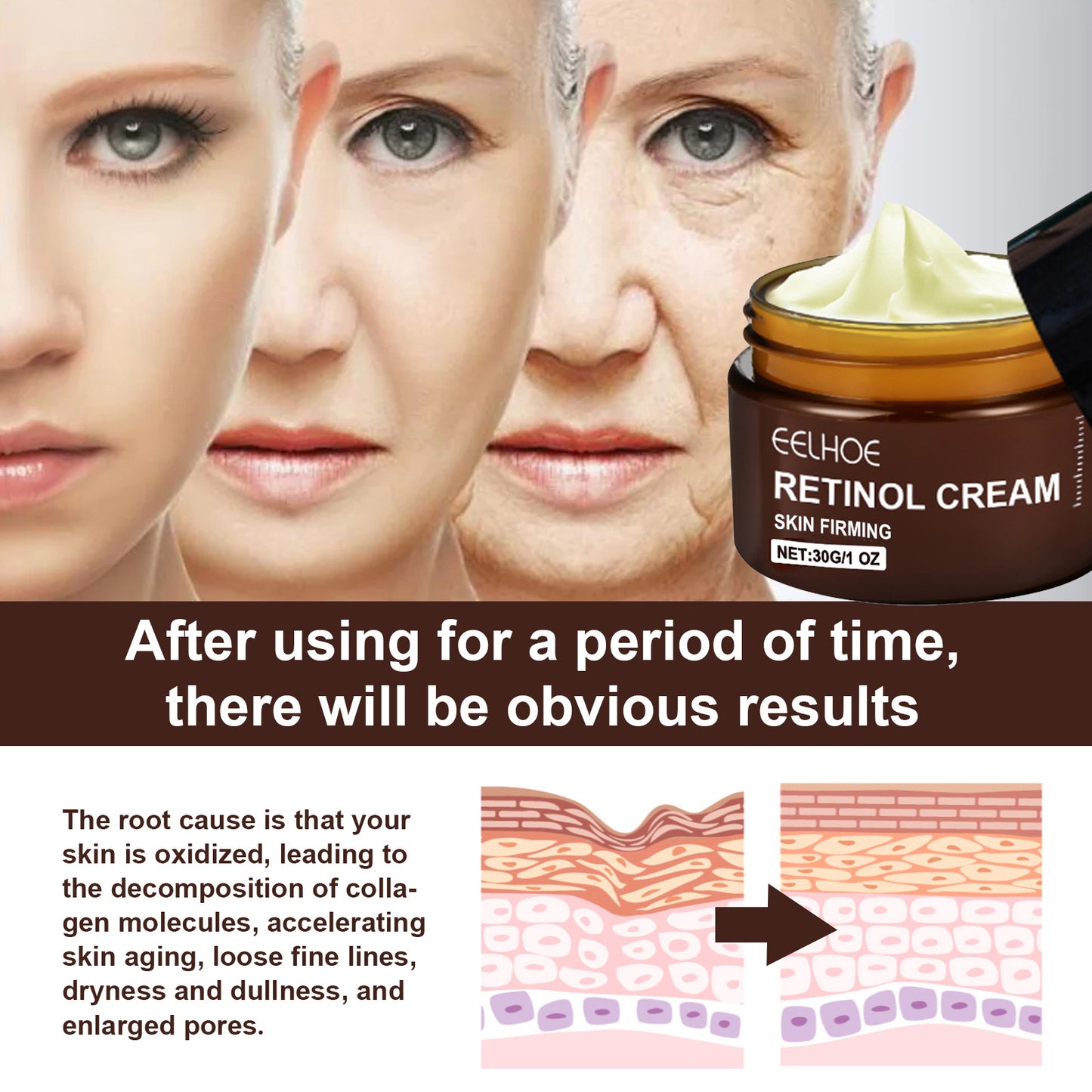 EELHOE Retinol Anti-Aging Cream – Firming, Brightening & Deep Moisturizing Face Cream for Wrinkles, Fine Lines & Youthful Skin Care Treatment( USA)