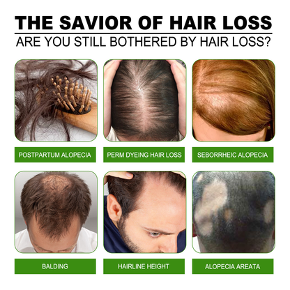 South Moon Anti-Hair Loss & Breakage Hair Growth Serum Hair Root Damage Repair Ginger Hair Serum (USA)