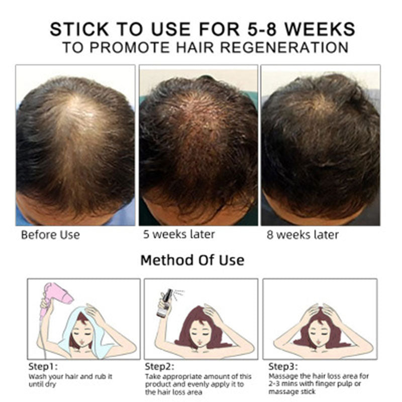 Herbal Hair Growth Oil for Thicker, Stronger Hair