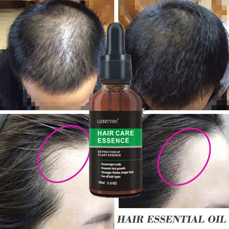 Herbal Hair Growth Oil for Thicker, Stronger Hair