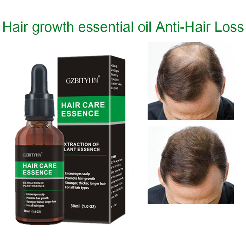 Herbal Hair Growth Oil for Thicker, Stronger Hair
