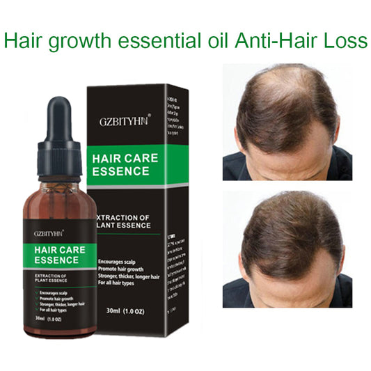 Herbal Hair Growth Oil for Thicker, Stronger Hair