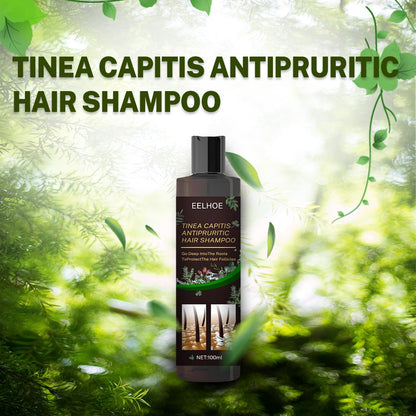 EELHOE Anti-Dandruff Shampoo – Itch Relief, Oil Control & Hair Loss Prevention Treatment for Flake-Free, Healthy Scalp (1pc / 2pcs Set) (USA)