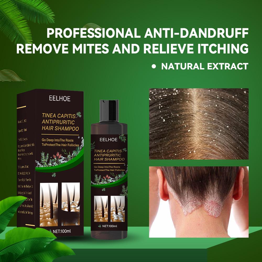 EELHOE Anti-Dandruff Shampoo – Itch Relief, Oil Control & Hair Loss Prevention Treatment for Flake-Free, Healthy Scalp (1pc / 2pcs Set) (USA)