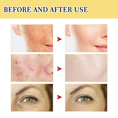 Snail Mucin Collagen Facial Serum – Hydrating Anti-Aging Essence for Brightening, Firming & Skin Repair