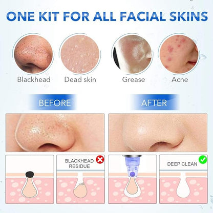 Before and after effects of a skincare kit on different skin types with illustrations.