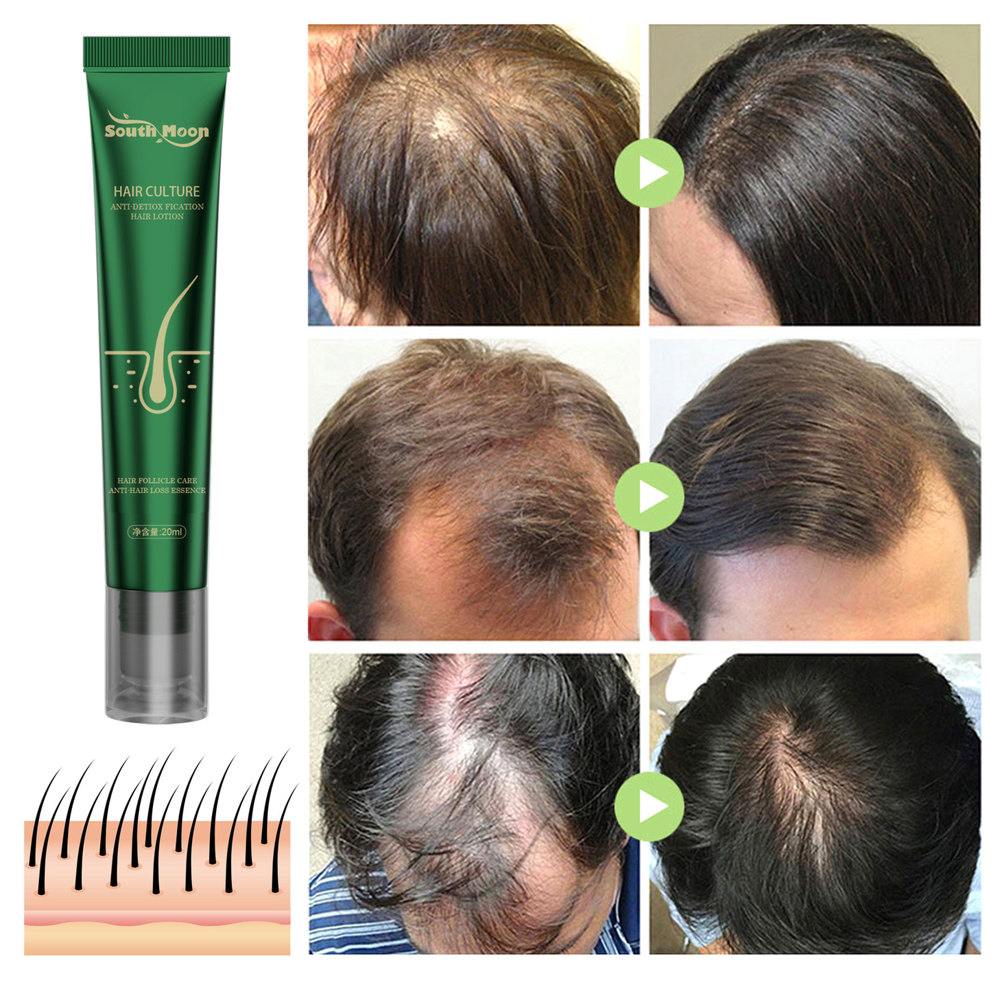 South Moon Anti-Hair Loss & Breakage Hair Growth Serum Hair Root Damage Repair Ginger Hair Serum (USA)