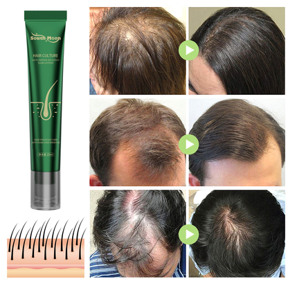 South Moon Anti-Hair Loss & Breakage Hair Growth Serum Hair Root Damage Repair Ginger Hair Serum (USA)