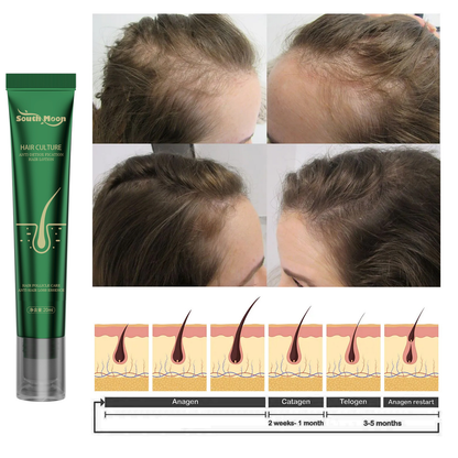 South Moon Anti-Hair Loss & Breakage Hair Growth Serum Hair Root Damage Repair Ginger Hair Serum (USA)