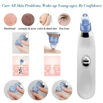 Facial cleansing device with images showing its use on skin issues.