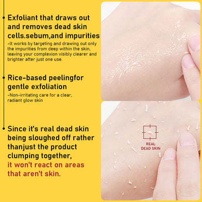 Papaya Enzyme AHA BHA Gentle Peeling Solution – Exfoliating Face Peel for Brightening, Acne & Dark Spot Removal (USA)