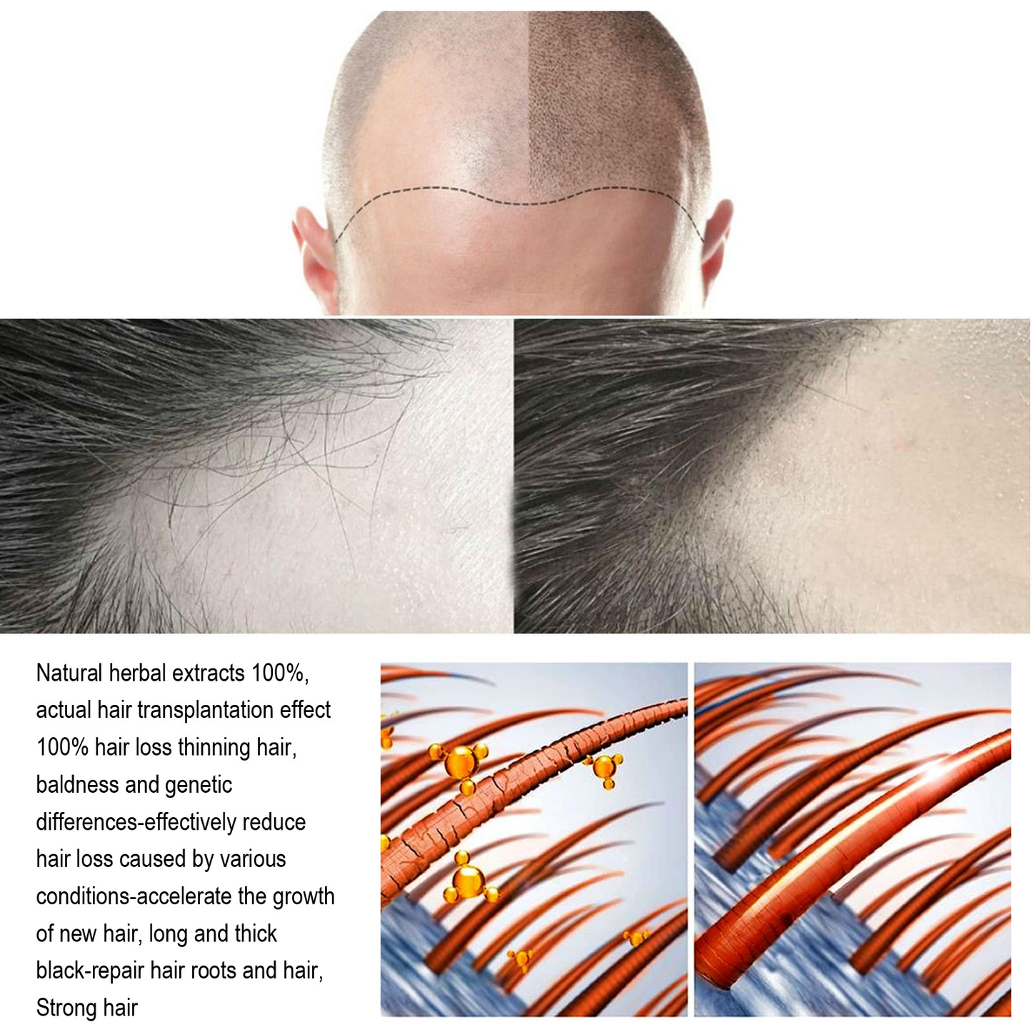 South Moon Anti-Hair Loss & Breakage Hair Growth Serum Hair Root Damage Repair Ginger Hair Serum (USA)