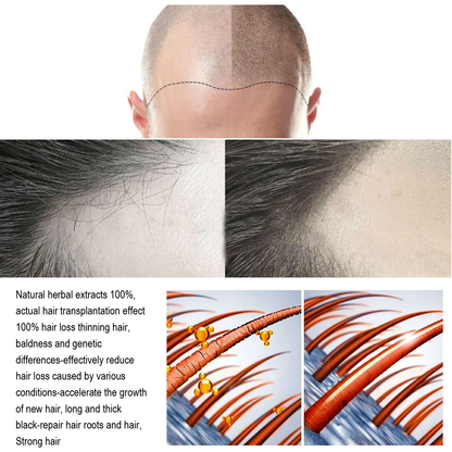 South Moon Anti-Hair Loss & Breakage Hair Growth Serum Hair Root Damage Repair Ginger Hair Serum (USA)