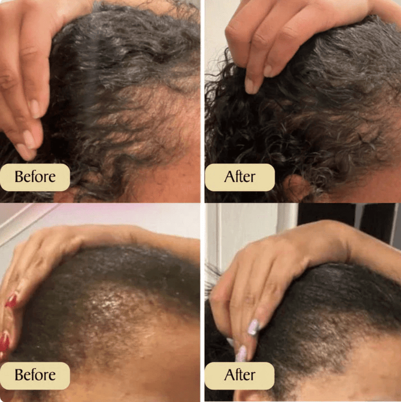 زيت لنمو الشعر – تركيبة ضد تساقط الشعر، لنمو سريع وتكثيف (الإمارات)